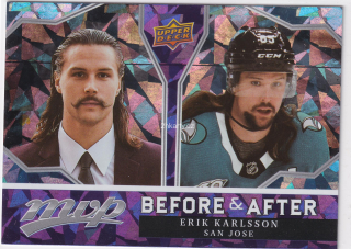 2021-22 UD MVP - Erik Karlsson - Before & After